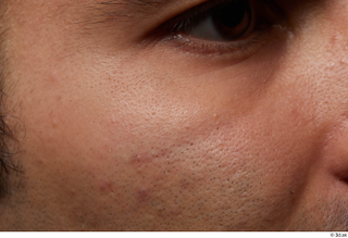 HD Face Skin Zufar Syed cheek skin pores skin texture…
